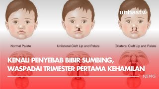 Download Lagu Kenali Penyebab Bibir Sumbing, Waspadai Trimester Pertama Kehamilan MP3