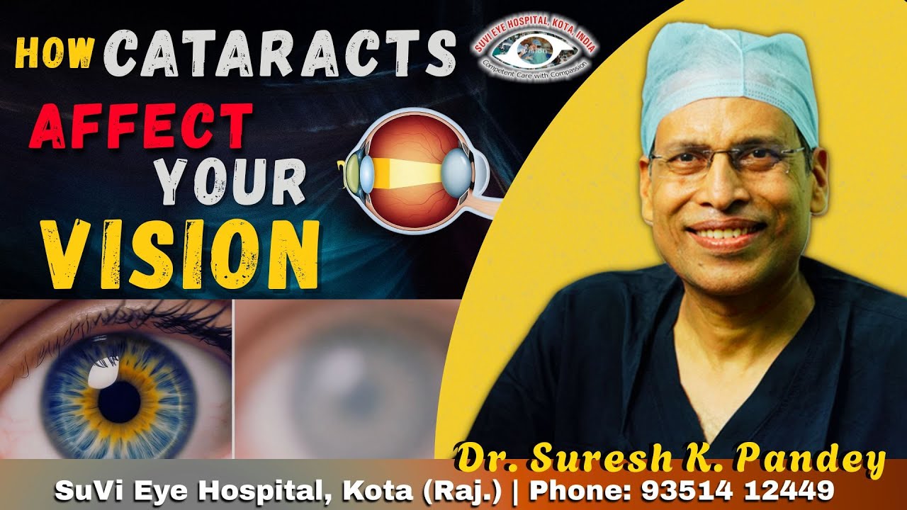 Understanding Cataract: Why Your Eye Lens Becomes Cloudy With Age | Dr. Suresh K. Pandey