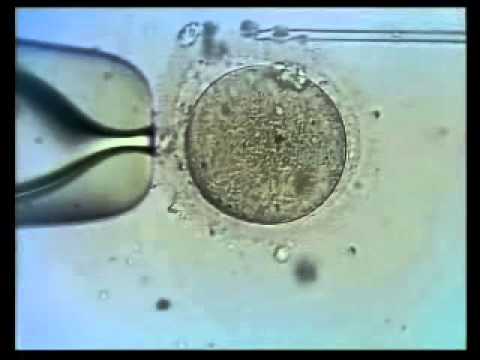 Einnistung unterstützen | Verhalten nach Embryotransfer