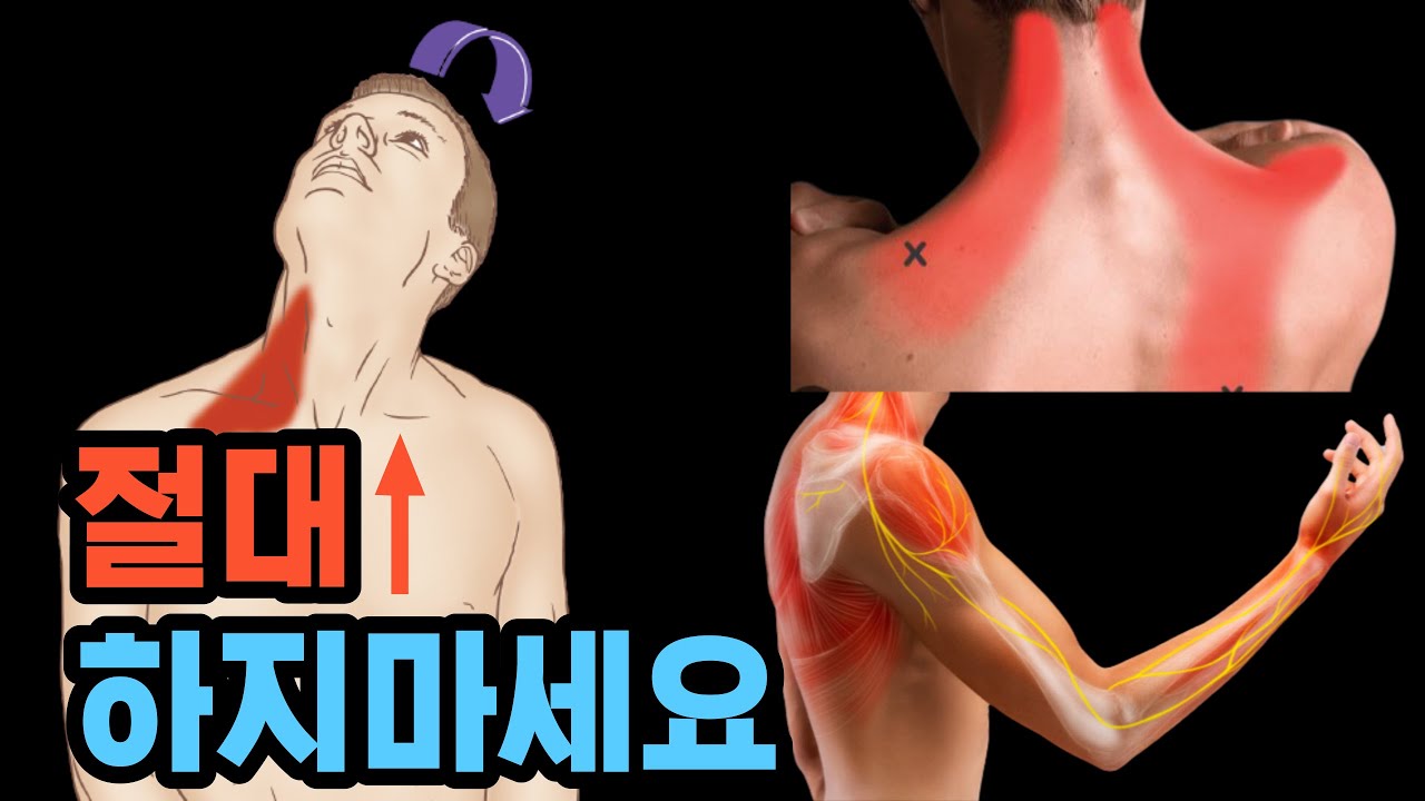 Если ваши руки и кисти онемели, попробуйте растянуть трапециевидные мышцы. Это также может помочь...