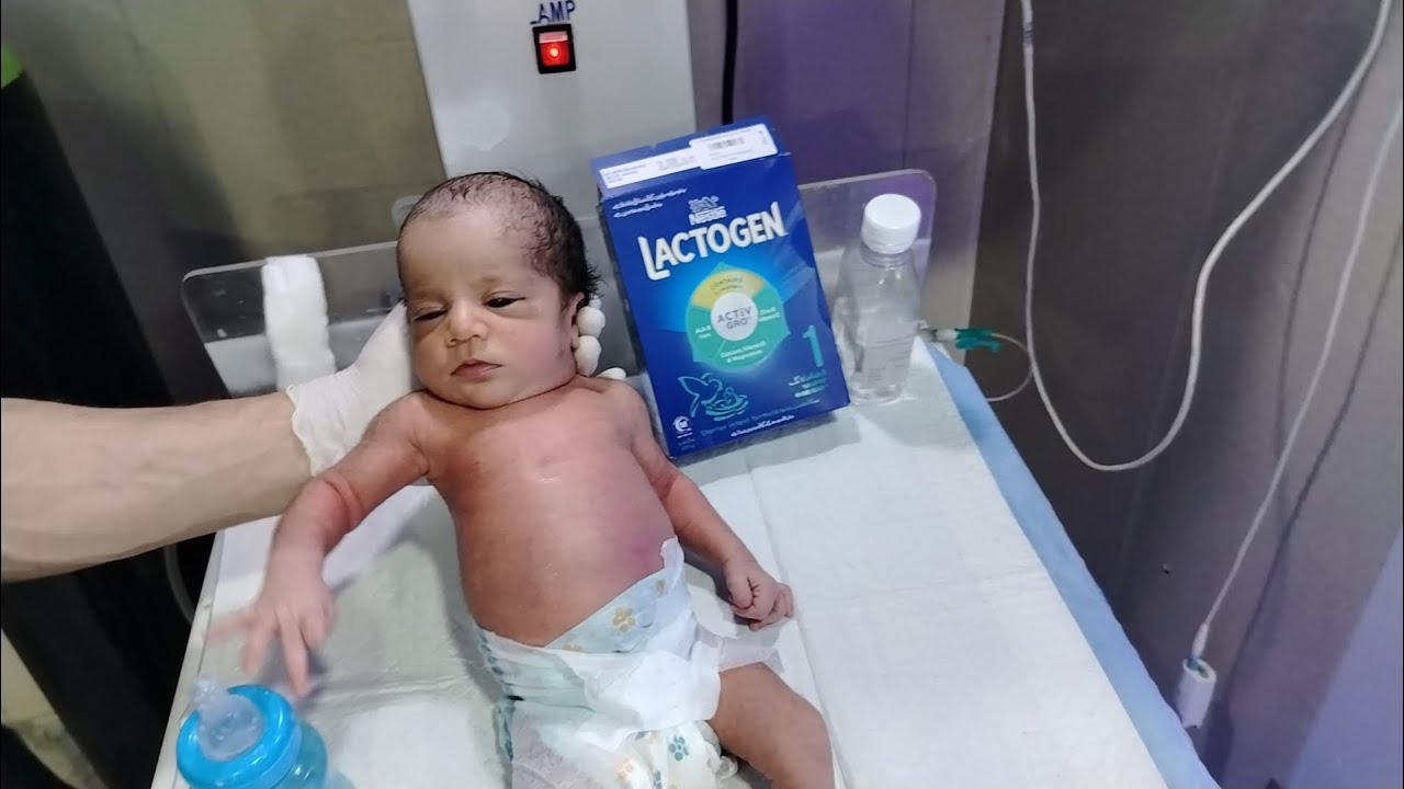 🍼NNJ (Neonatal Jaundice) Baby How to Start Formula Feeding with Proper Medical Protocol Safe Feeding