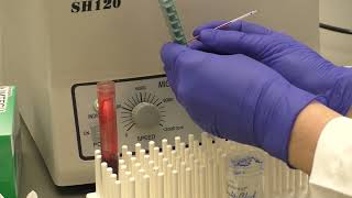 Microhematocrit Determination