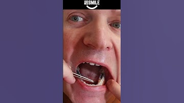 Floss Threader Hack #shorts