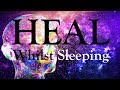 HEAL Your Body Mind, Whilst You Sleep - POWER of Focused Desire (Guided Meditation)