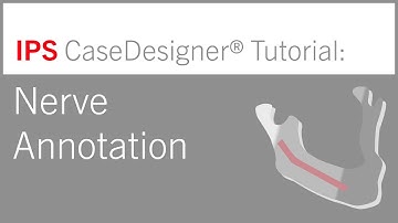 Workflow optional – Nerve Annotation | IPS CaseDesigner® Tutorial