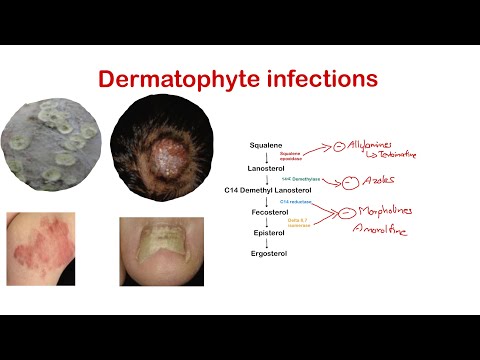 Video: Dermatophytosis (ringworm) i tvoj ljubimac