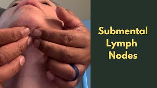 Lymph node: Submental-Where is it? What Does Swelling Mean?