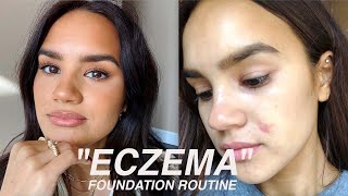 Drugstore Foundation Routine for Eczema Skin Types | Dacey Cash
