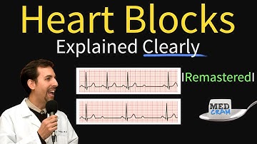 Heart Blocks Explained - First, Second, Third Degree and Bundle Branch on ECG