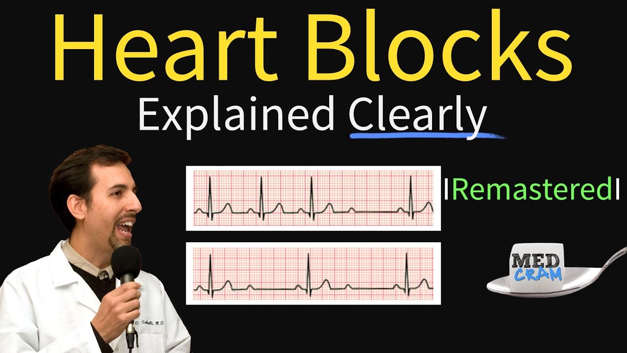 Heart Blocks Explained First Second Third Degree And Bundle Branch On Ecg Youtube