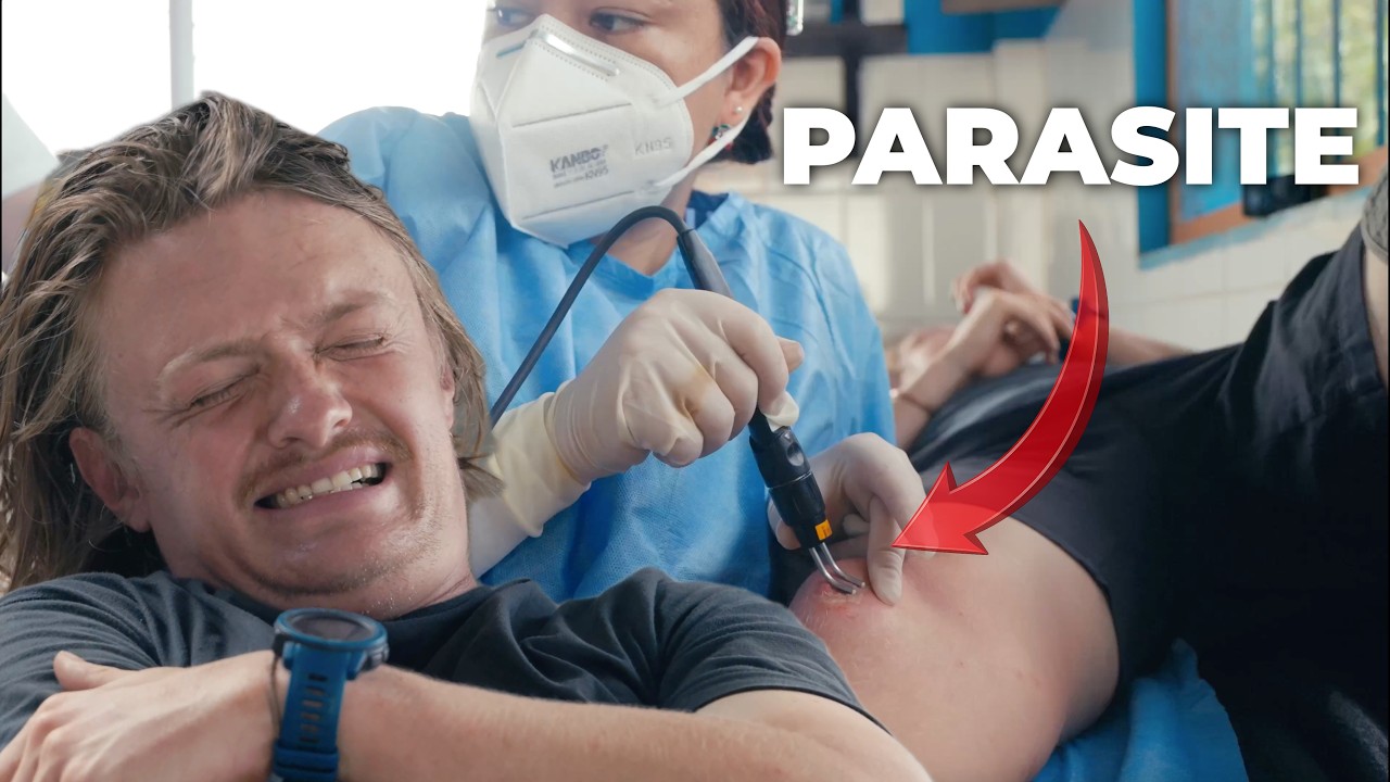 Burning My Jungle Parasite in The Amazon