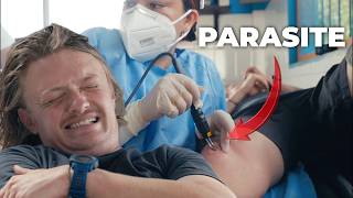 Burning My Jungle Parasite in The Amazon