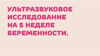 5 неделя беременности: УЗИ. Как выглядит плод на 5 неделе ?