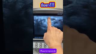 มือชา!!!