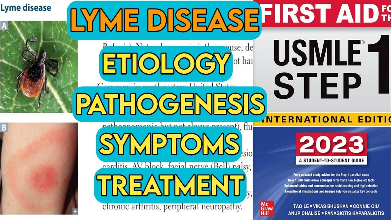 Lyme disease borrelia burgderofi lyme disease with mnomonic