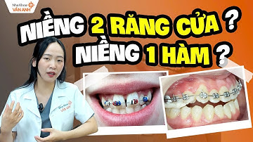 Niềng 2 Răng Cửa, Niềng 1 Hàm Có Được Không? | Giải Đáp Những Lầm Tưởng Tai Hại Khi Niềng Ít Răng