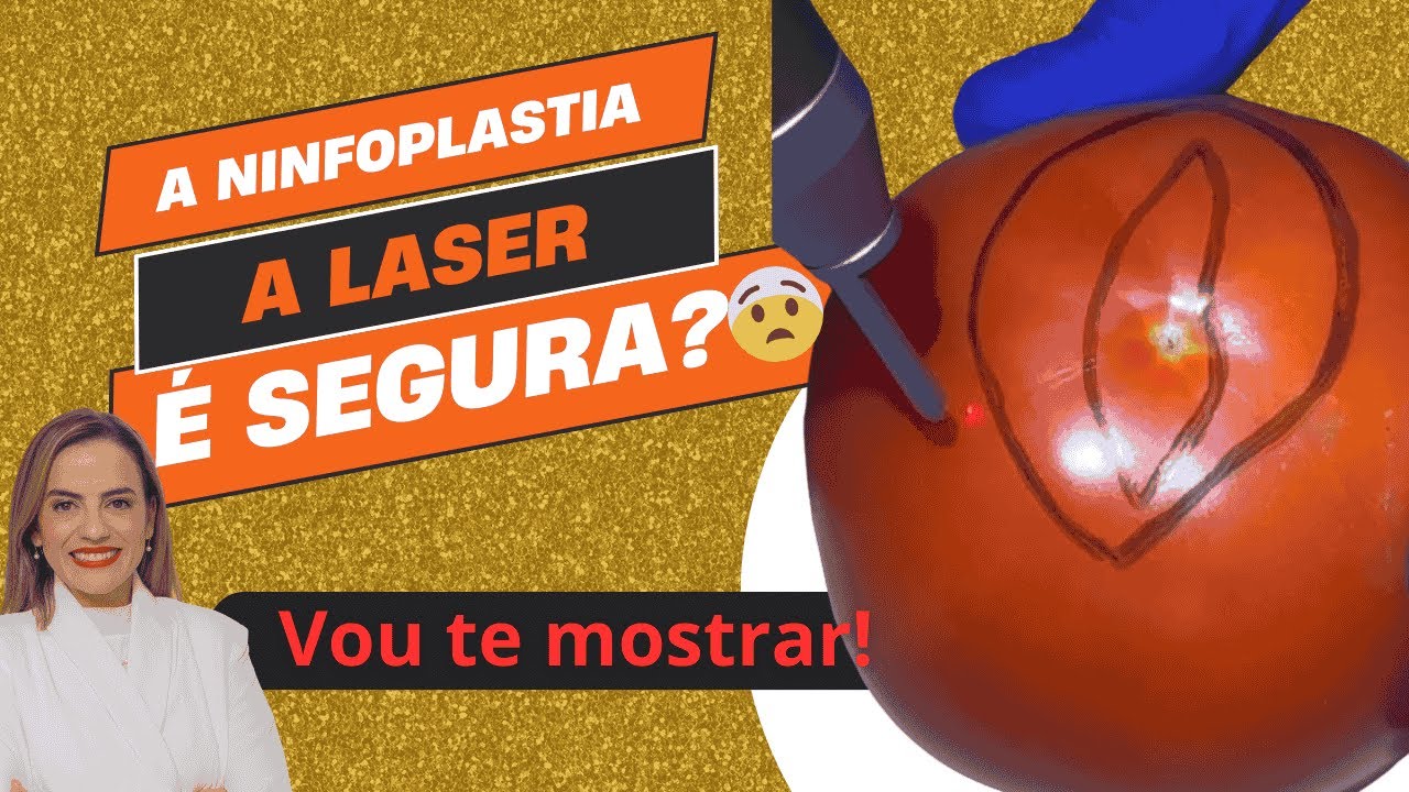 NINFOPLASTIA É SEGURO? A cirurgia que reduz os pequenos lábios a laser ...