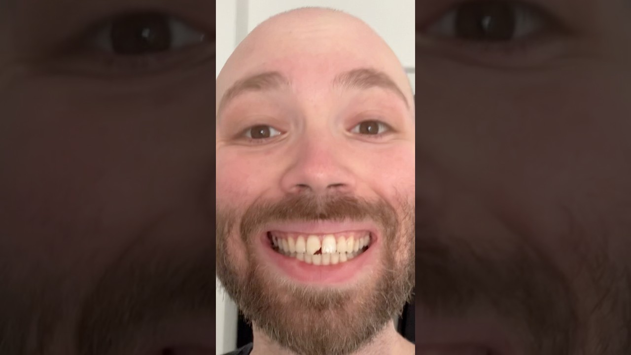 I JUST GOT HOME FROM THE HOSPITAL AND THIS HAPPENED