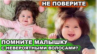 Как Сегодня Выглядит Девочка, Которая Родилась С Огромной Шевелюрой