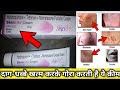 सबसे जल्दी गोरा करती है ये क्रीम,देखो कैसे // Skinlite cream review SG support // Acne, pimple,spots