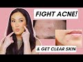 Top Skincare Ingredients to Fight Acne &amp; Get Clear Skin!