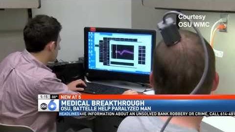 New Device Allows Brain to Bypass Spinal Cord