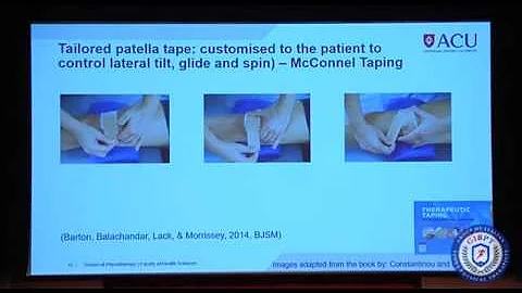 15.Maria Constantinou: clinical expertise and Taping