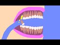 【Algodoo】Pull out all teeth. 　歯を全部抜く