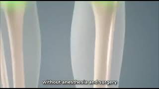 Shockwave therapy Portable for Erectile Dysfunction ED Treatment screenshot 4