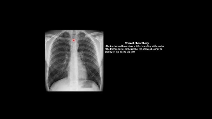 Katta kokrak qafasi haqida video Katta kokrak qafasi haqida video