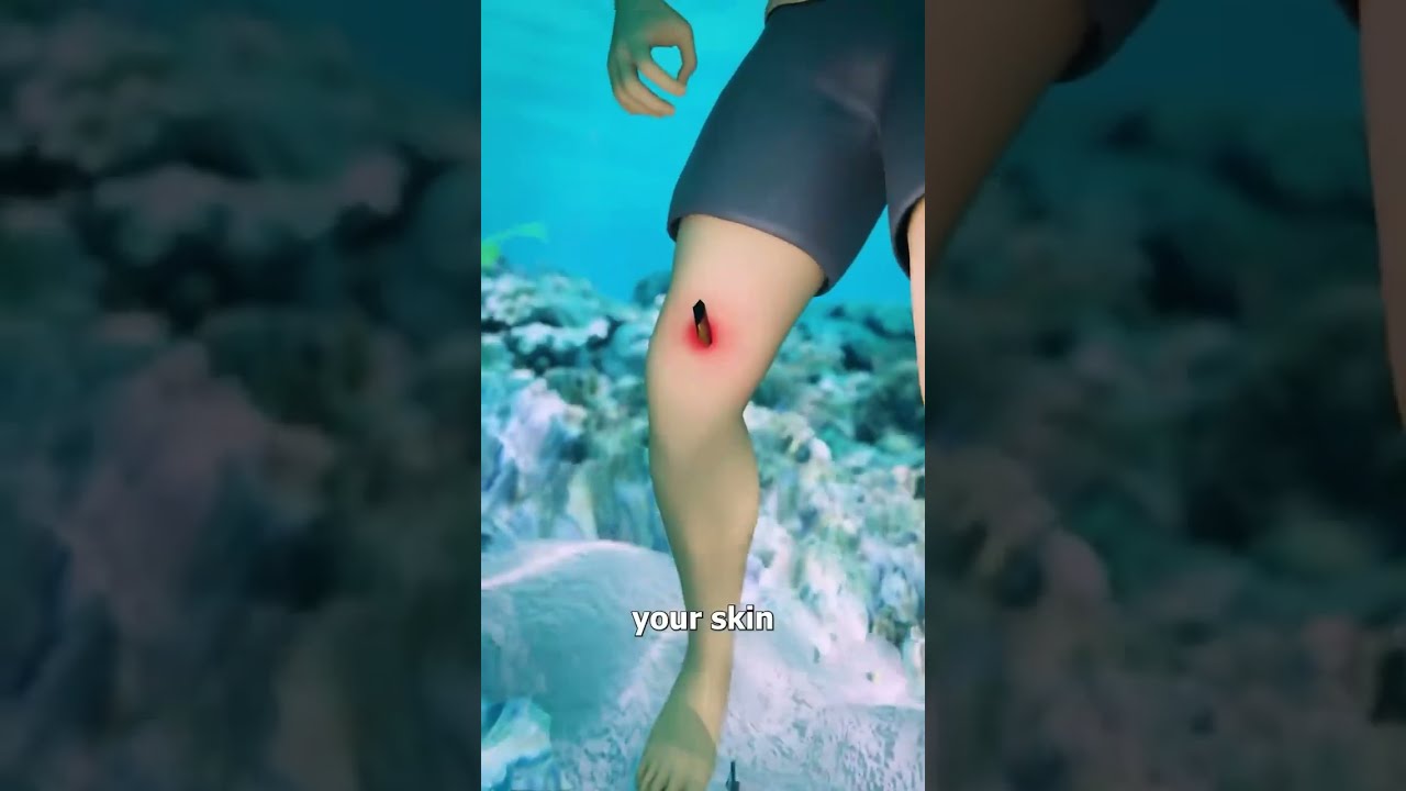 How Stingrays Actually Sting You 