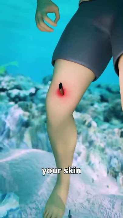 How Stingrays Actually Sting You 😳
