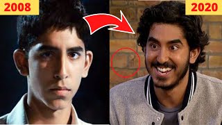 Famous Slumdog Millionaire Cast ⭐ Then & Now Profile