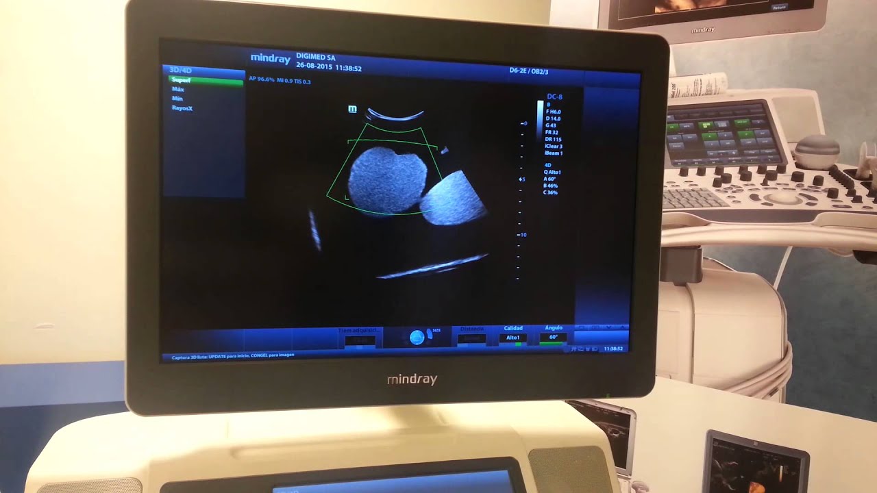 DC 8 Parte 4 de 4   3D, 4D y iLive