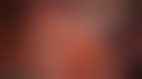 VATS Left Lingular (S4+5) Segmentectomy