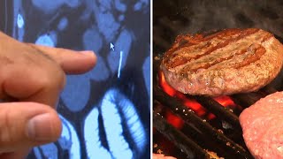 How a Burger From the Grill Could Land You in the Emergency Room