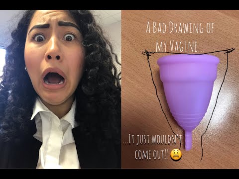 Can Menstrual Cup Get Lost? Menstrual Cup Stuck Inside