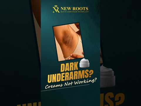 Get Rid of Dark Underarms & Bikini Area Pigmentation! #darkunderarms #pigmentation #shorts