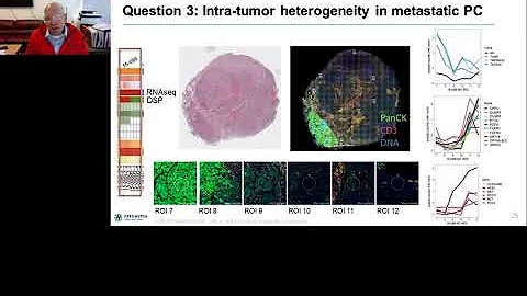 Spatial landscape of the immune microenvironment i...