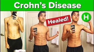Download Lagu 16 year-old Heals Crohn's disease on a Plant-based diet Download Lagu 16 year-old Heals Crohn's disease on a Plant-based diet