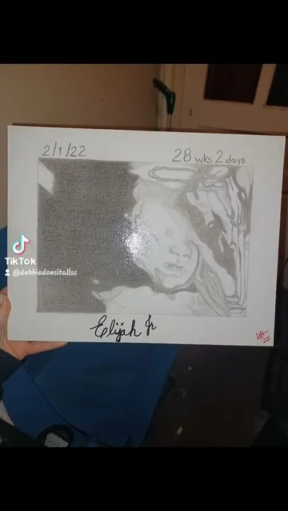 own no rights to the music...3D ultrasound I did.....