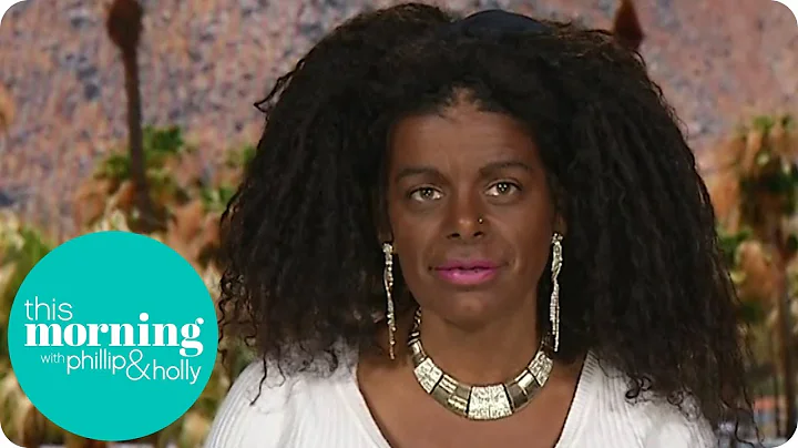 I Was Born White but I Prefer Being Black | This M...