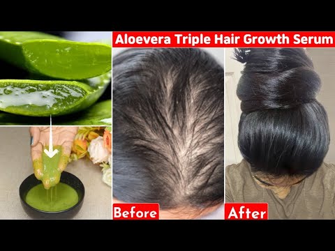 This👆🏼Aloevera Trick-Turned My Bald Hair to Thick Heavy Hair- 30 Days ...