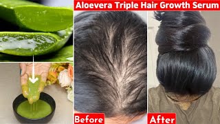 Thisaloevera Trick-Turned My Bald Hair To Thick Heavy Hair- 30 Days-Hair Loss To Thick Dense Hair