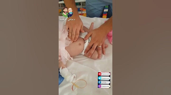 أحسن طريقة للتخلص من الغازات عند الرضيع