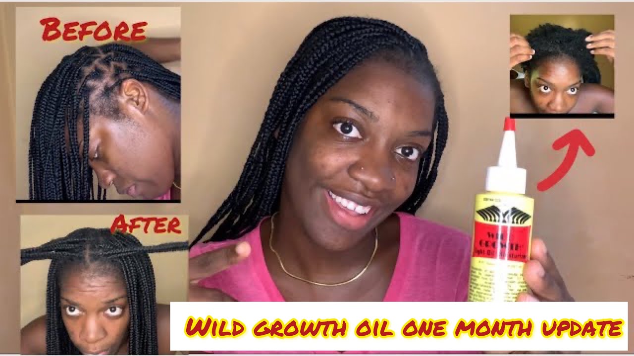 I Used Wild Growth Oil For ONE MONTH!MASSIVE HAIR GROWTH 2021