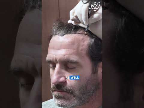 What Happens During