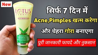 Athlete Statistics Lotus Neem Face Wash Review | lotus herbals neem face wash | lotus face wash