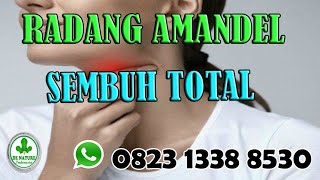 Obat Radang Amandel Paling Ampuh Di Apotik