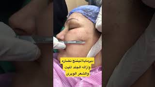 ديرمابلانيننج تفتيح ونضاره ازاله الشعر الوبرى والجلد الميت تجميل تفتيح تخسيس تفتيح_البشرة 99fm